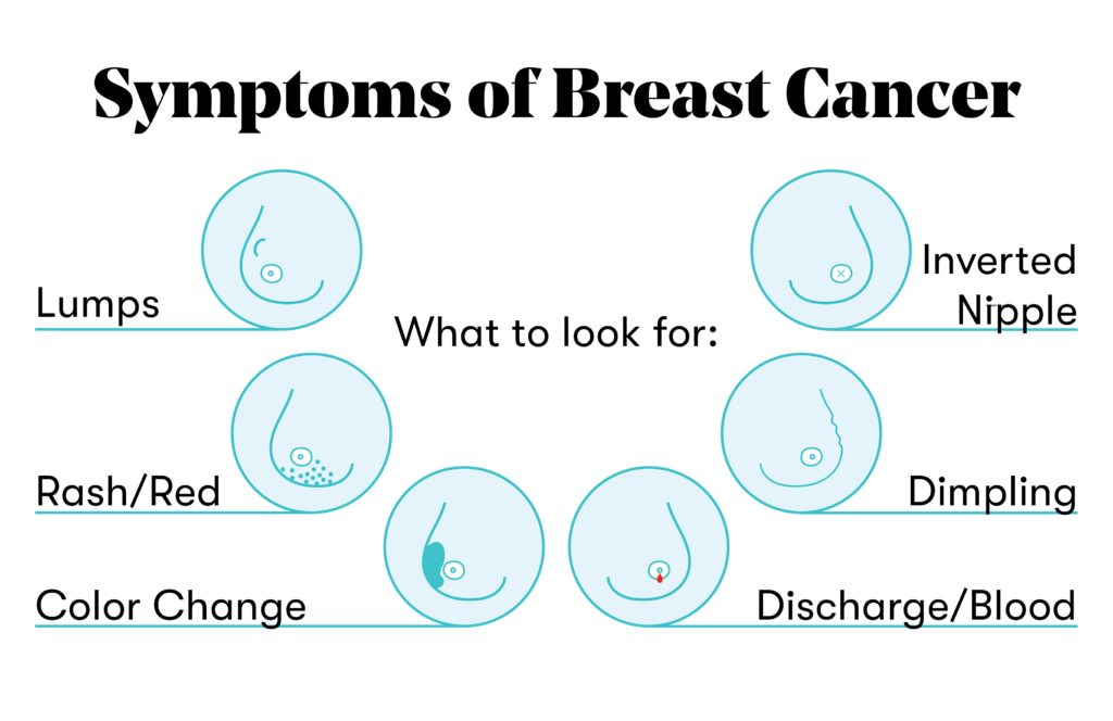 Symptoms of breast cancer and what to look for
