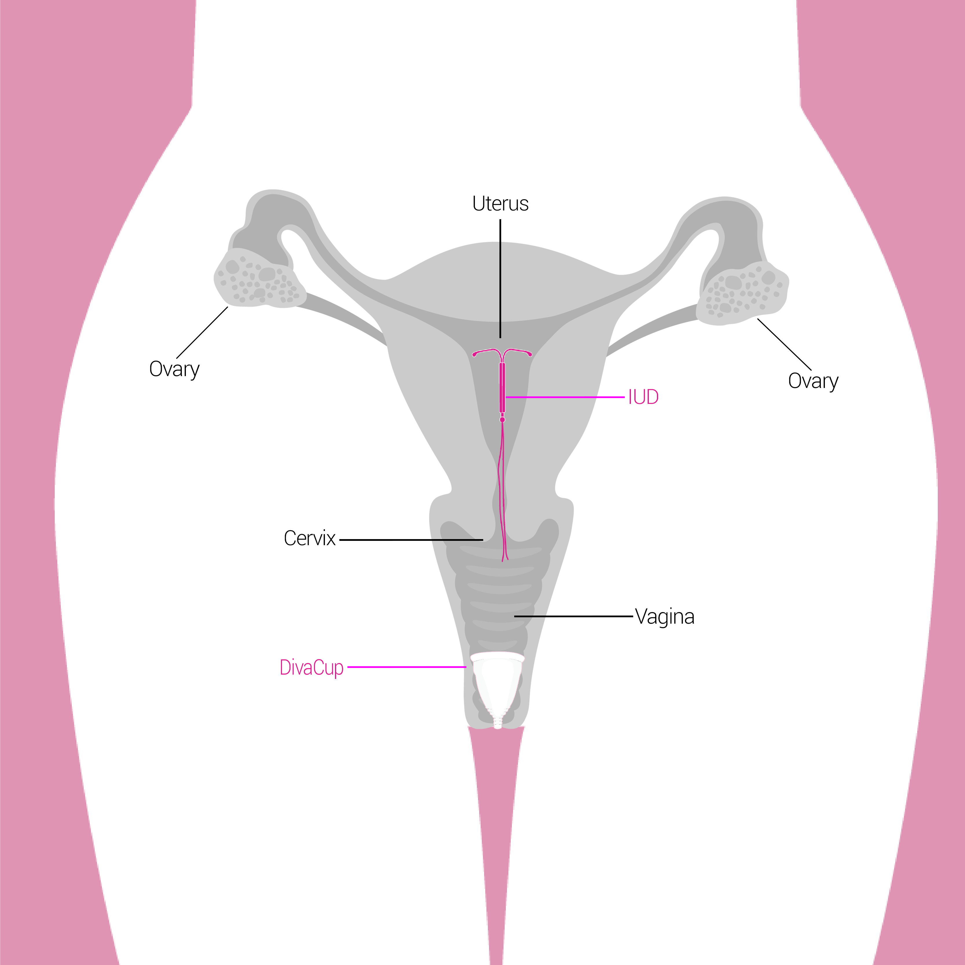 IUDs And The DivaCup | Menstrual & DivaCup Facts